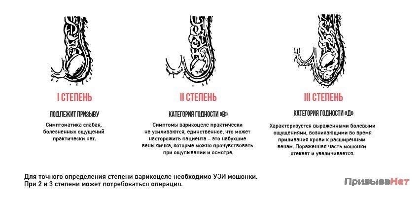 Если у вас варикоцеле и вам грозит призыв в армию, первым делом пройдите тщательное медицинское обследование. Врач оценит степень тяжести заболевания, в частности проверит, влияет ли варикоцеле на вашу способность служить. Главное - влияет ли заболевание на функцию пораженного яичка или приводит к таким осложнениям, как атрофированные яички, что может служить основанием для освобождения от службы по медицинским показаниям.