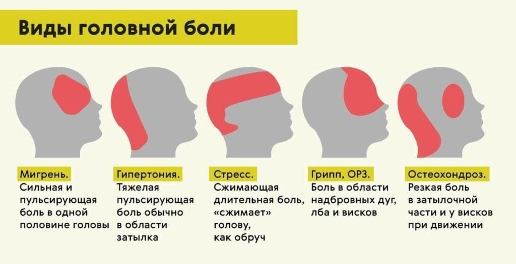 Лица, страдающие частыми и сильными головными болями, могут столкнуться с проблемами в процессе призыва. Наличие таких симптомов, как аура, сильная боль и изнурительные приступы, может вызвать опасения относительно способности человека соответствовать физическим требованиям воинской службы. Особый вопрос заключается в том, могут ли эти состояния, которые часто носят эпизодический, но интенсивный характер, отказать человеку в призыве на военную службу.